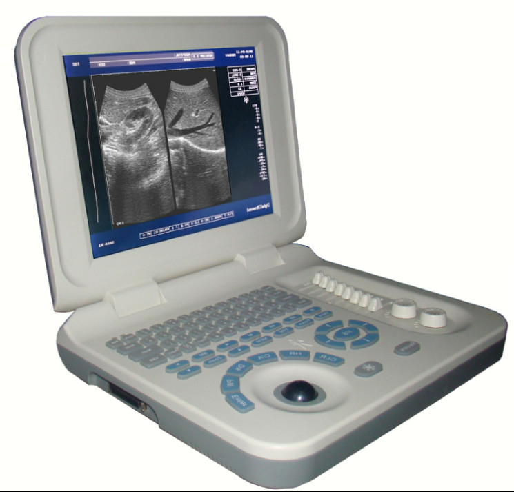 Biens diagnostiques de scanner d'ultrason de Digital de machine d